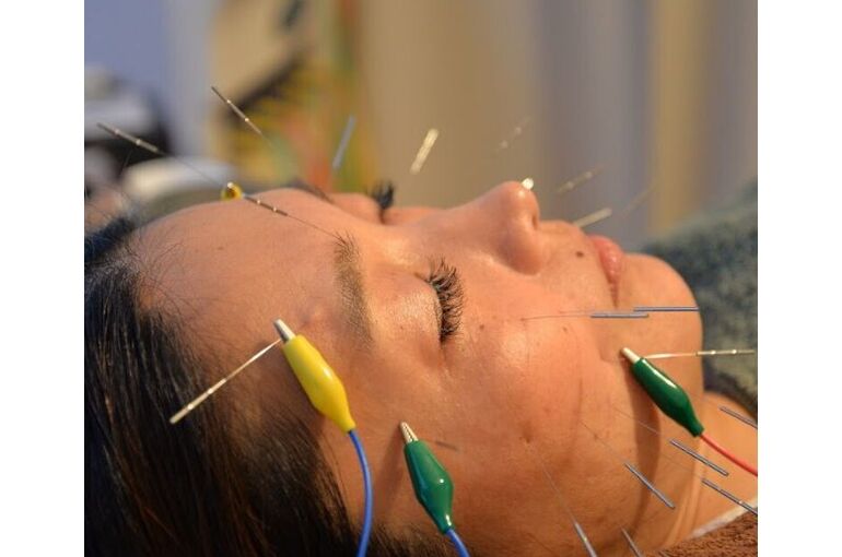 1BB045E7-486B-4B8C-8861-613D6E63EB2E