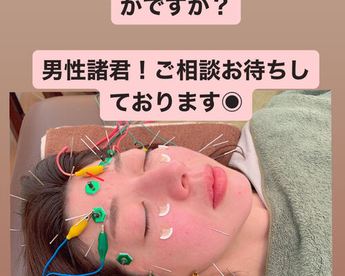 美容鍼の風景です
